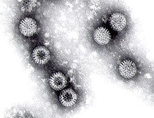 Ротавирус в электронном микроскопе